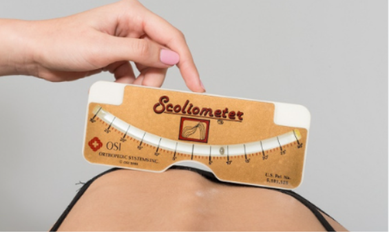 Badanie skoliometrem